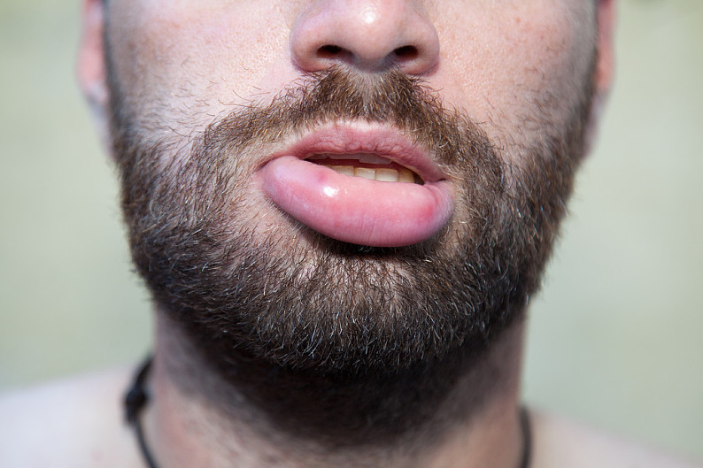 男人面相学哪个上嘴唇，图_男人嘴唇发干是什么原因_男人嘴唇痣相最准图